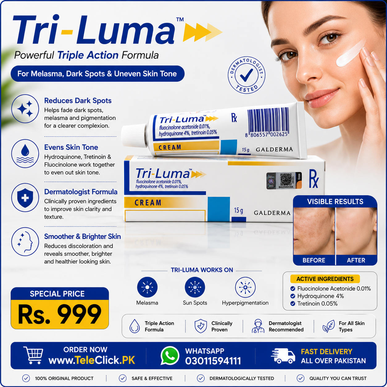 New Tri Luma Cream In Pakistan