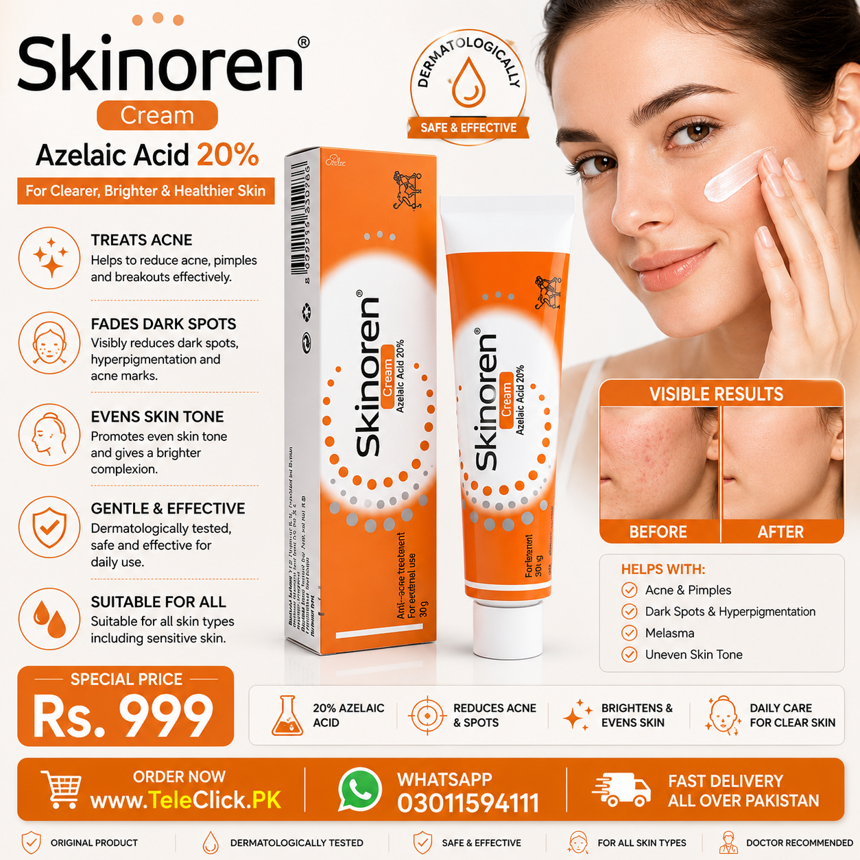 New Skinoren Cream In Pakistan
