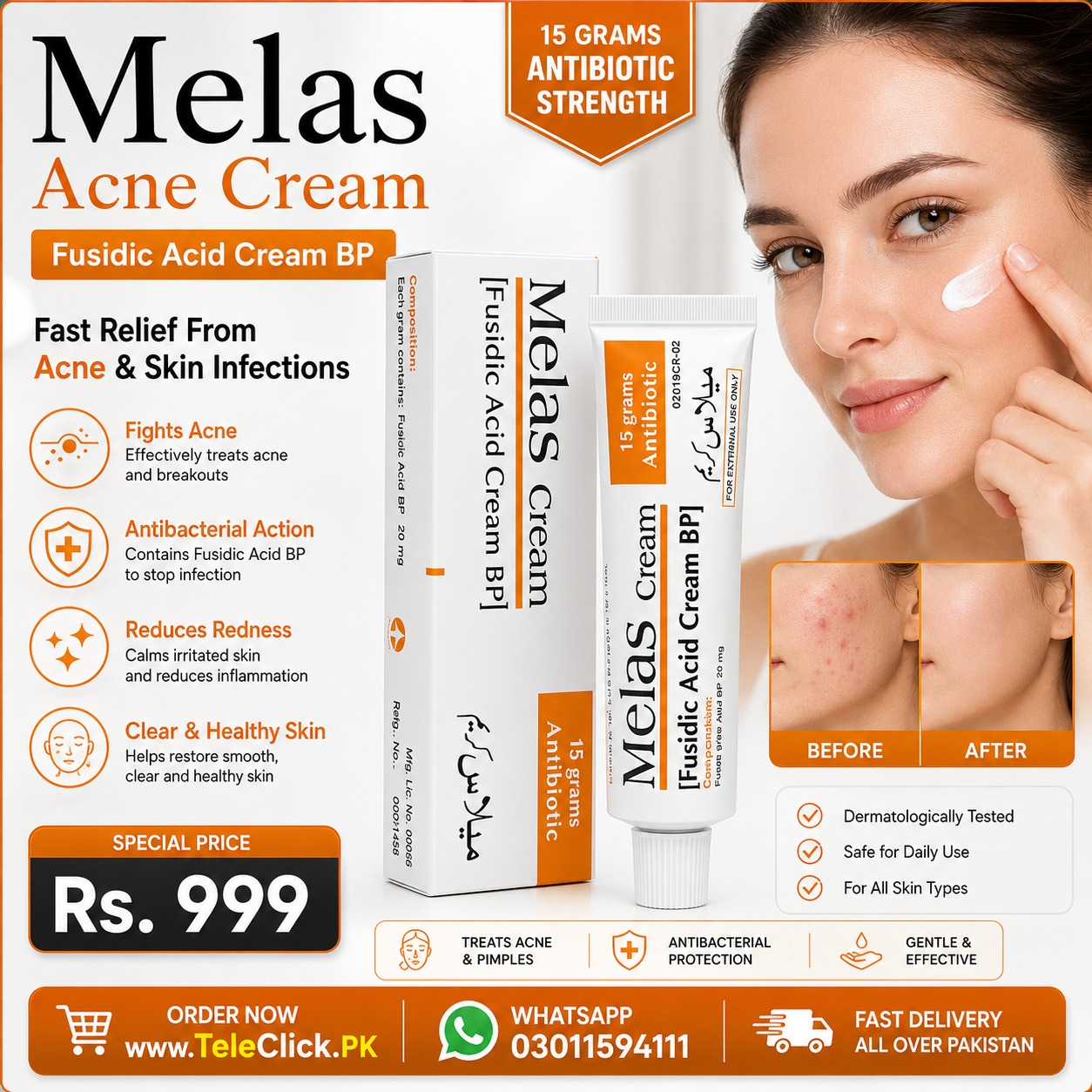New Melas Acne Cream In Pakistan
